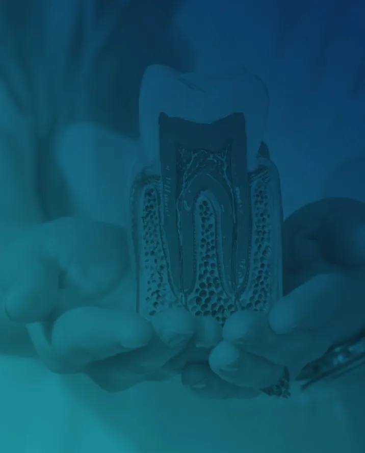 Kanal Tedavisi (Endodonti) — Konya Konya Diş Hekimi diş kliniği